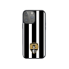 NOTTS Striped iPhone Cover